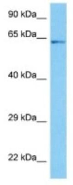 CYP2U1 Rabbit anti-Human, Polyclonal, Novus Biologicals:Antibodies:Primary